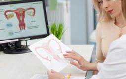 Фото: Как диагностируют синехии в матке